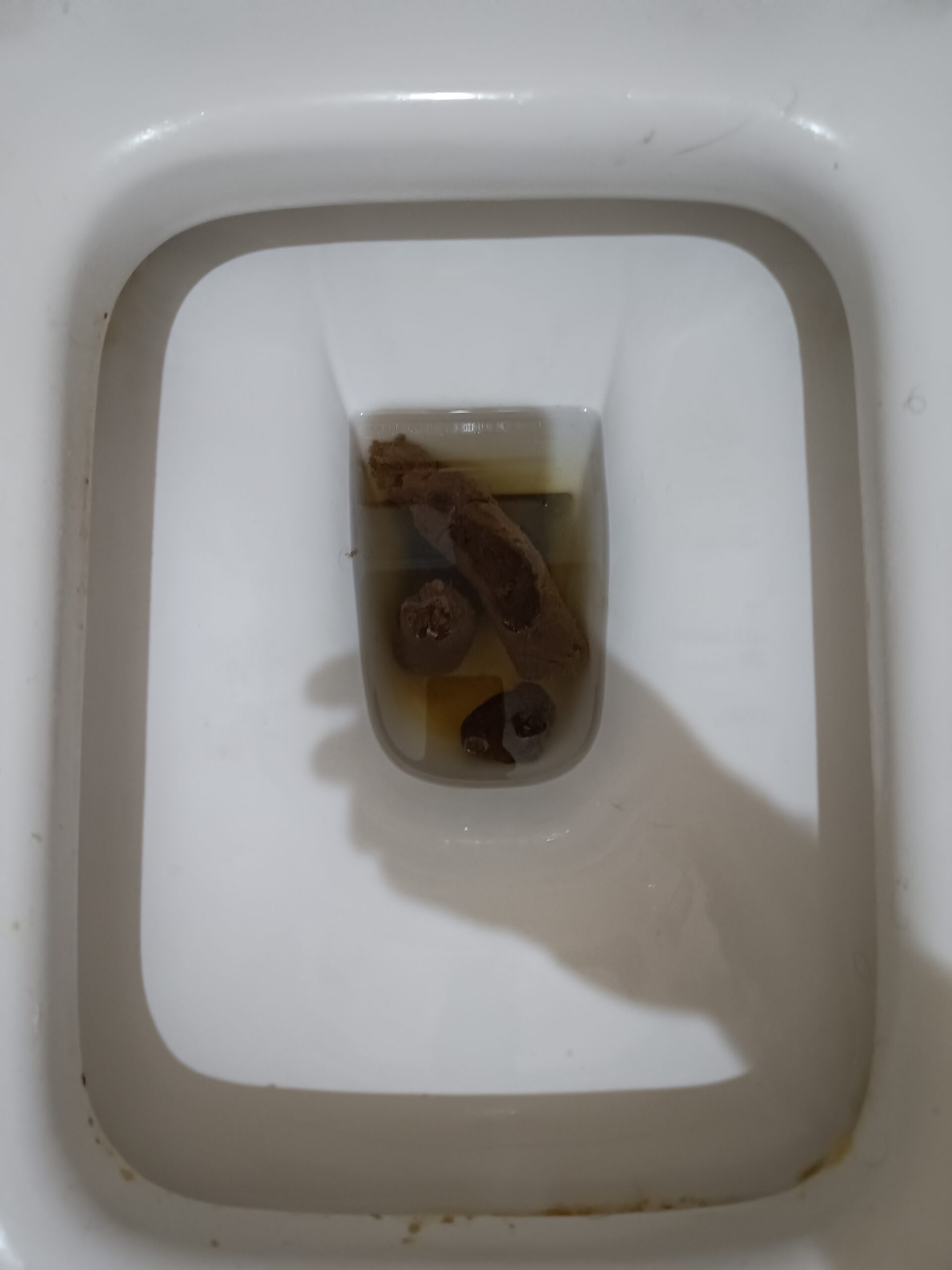 Bristol 4 Triplets Stool!